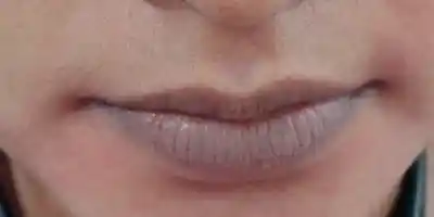 Before SPMU — uneven lip tone and undefined border