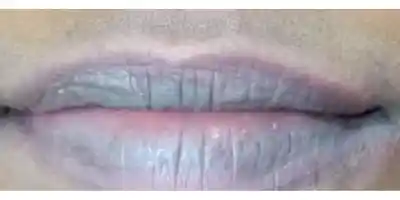 Before SPMU — thin, pale lips with minimal definition